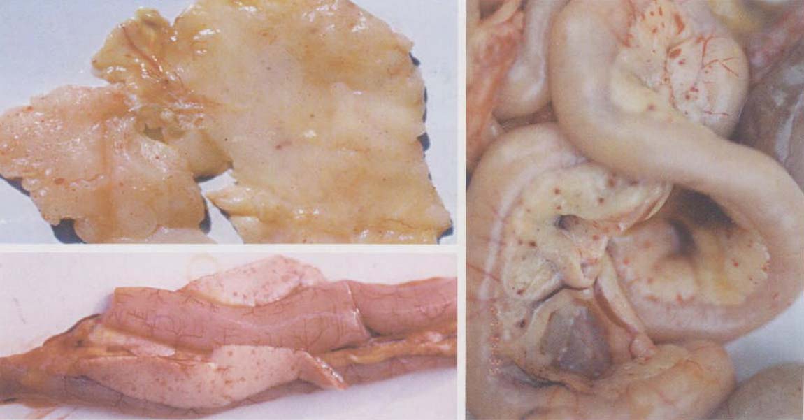 腹部脂肪(左上)、胰腺 (左下)、 肠系膜(右) 出血.jpg